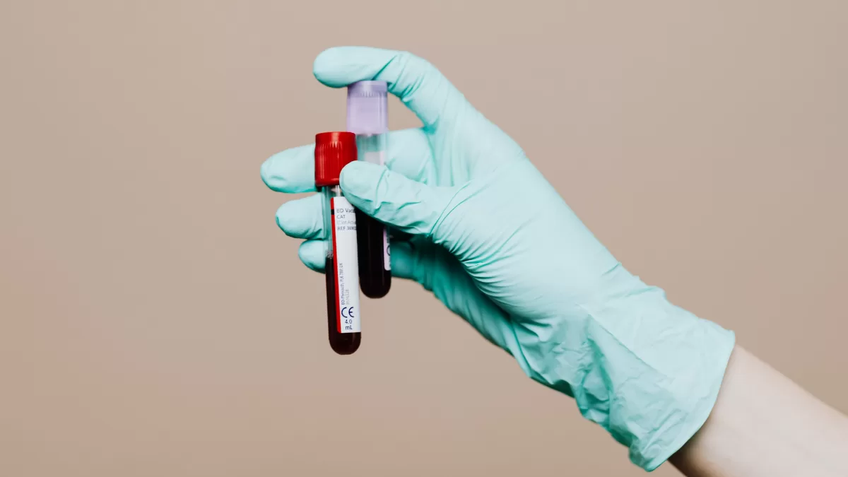 Exames Laboratoriais na Prática Esportiva: o Papel do Nutricionista na Interpretação dos Marcadores de Rendimento e Recuperação