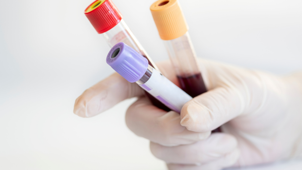 Três exames laboratoriais que podem confundir o nutricionista