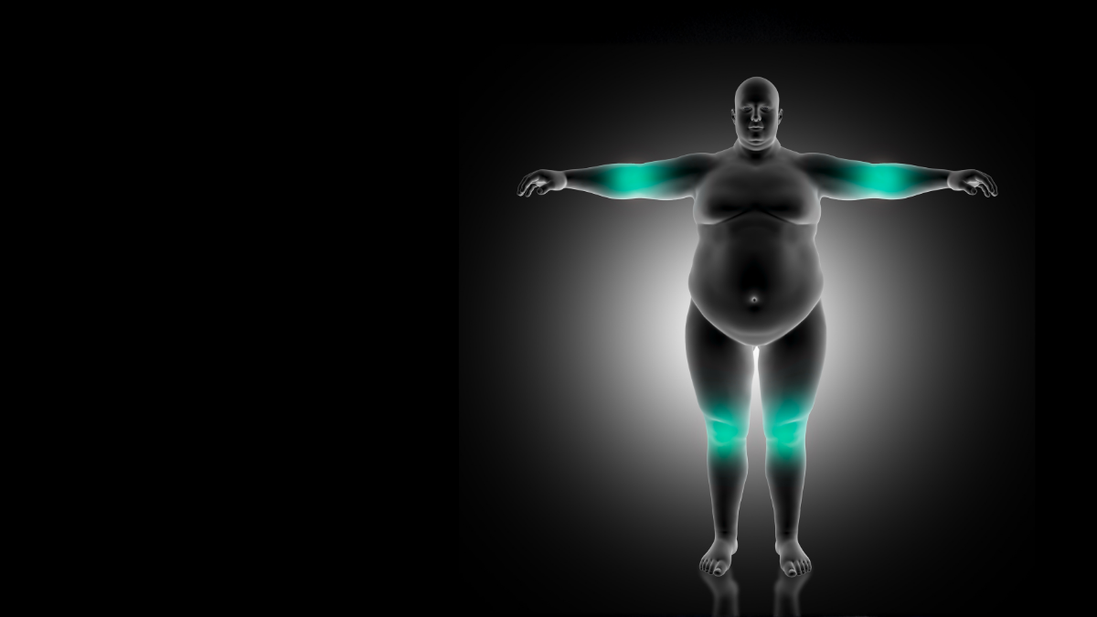 Obesidade sarcopênica: quando excesso de gordura e perda muscular coexistem